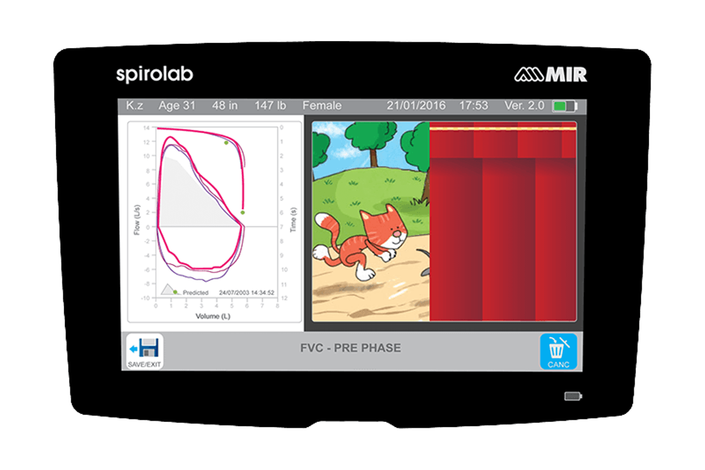 Mir Spirolab Masaüstü SpirometreCebri Medikal