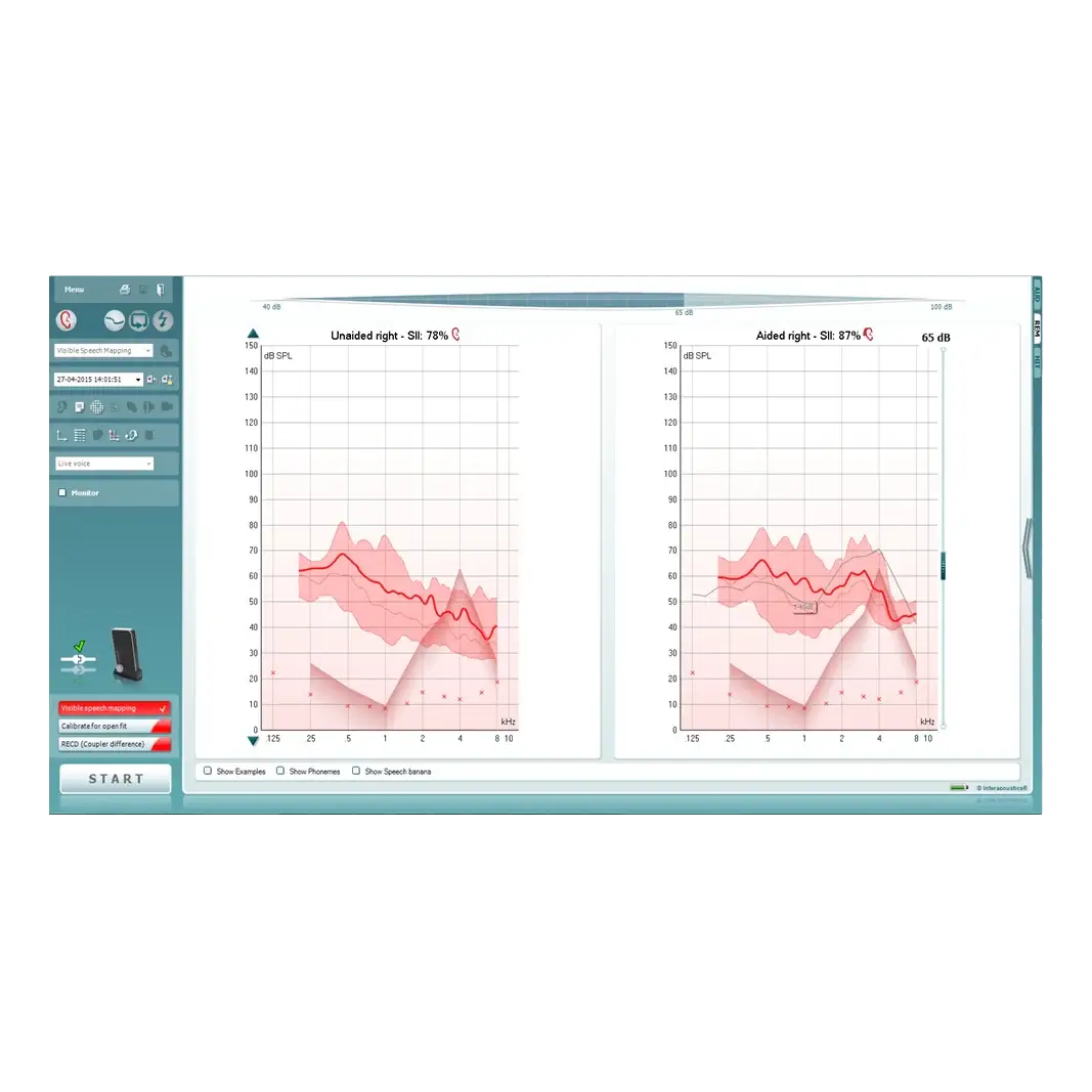 interacoustics Calisto Rem Cİhazı - Real Ear MeasurmentCebri Medikal