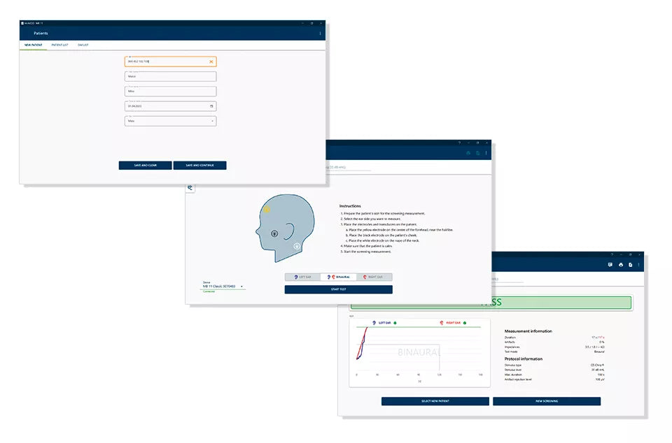 Maico Mb 11 Bera Phone Yenidogan Abr CihazıCebri Medikal